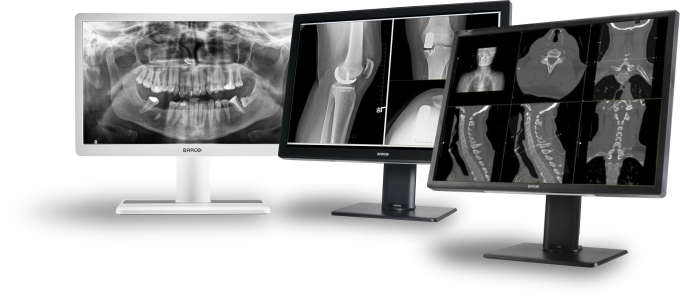 Barco - seria monitorów Coronis, Eonis i Nio