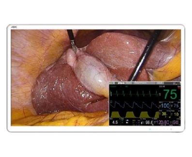 BARCO 31” 4K UHD monitor chirurgiczny MDSC-8231